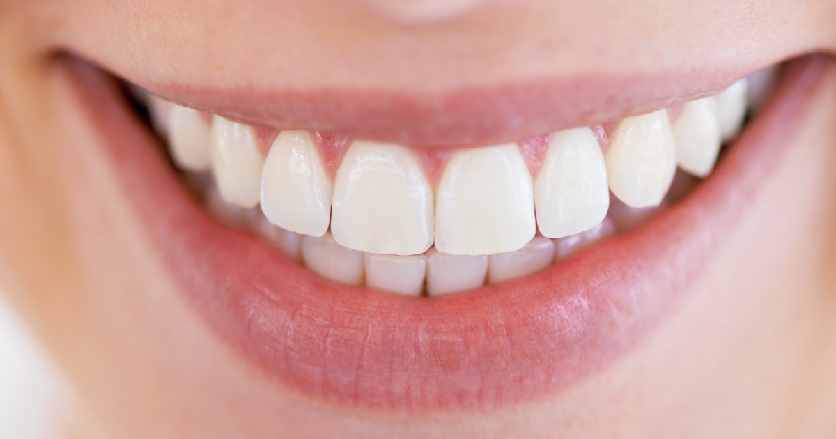 Get a Brighter Smile and Don't Break the Bank with Zoom Whitening